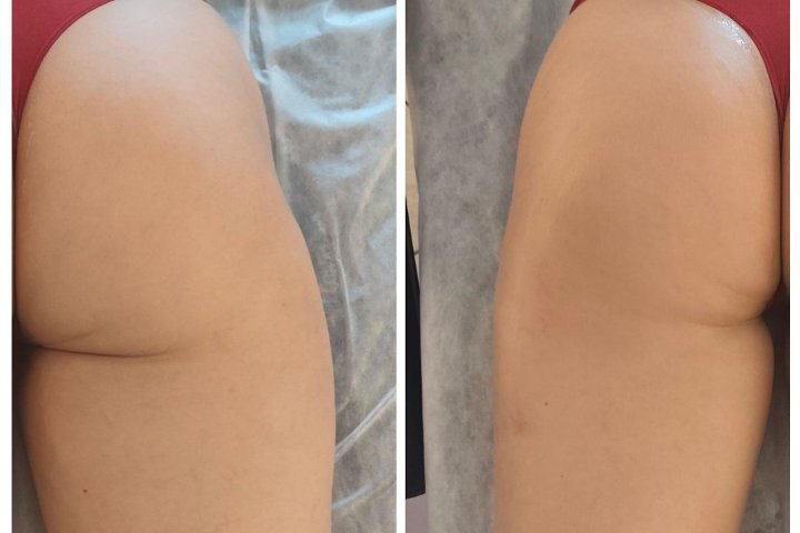 SkinLift RF by Ieva, studijos nuotrauka